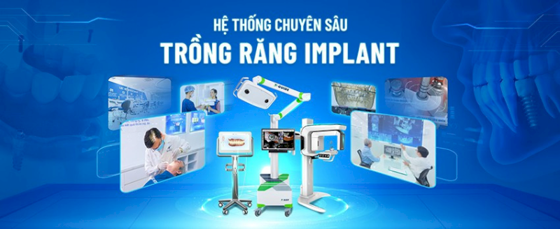 Nha khoa Lạc Việt Intech đảm bảo các thiết bị hỗ trợ cắm Implant được vô trùng tuyệt đối theo trình tự 