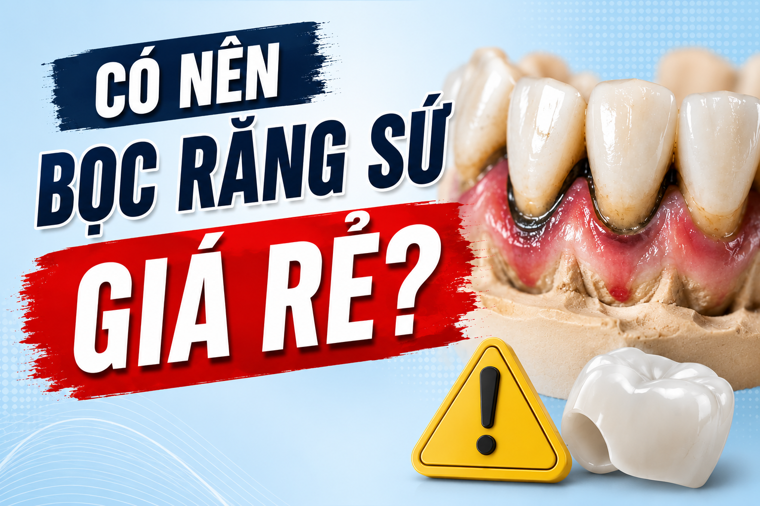 Có nên bọc răng sứ giá rẻ không? Sự thật sau những chiếc răng sứ có giá vài trăm nghìn