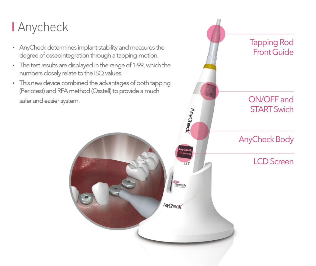 Công nghệ Anycheck giúp bác sĩ xác định mức độ tích hợp xương