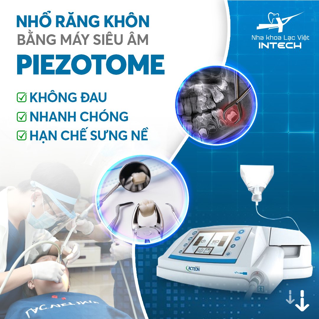 Công nghệ nhổ răng siêu âm Piezotome