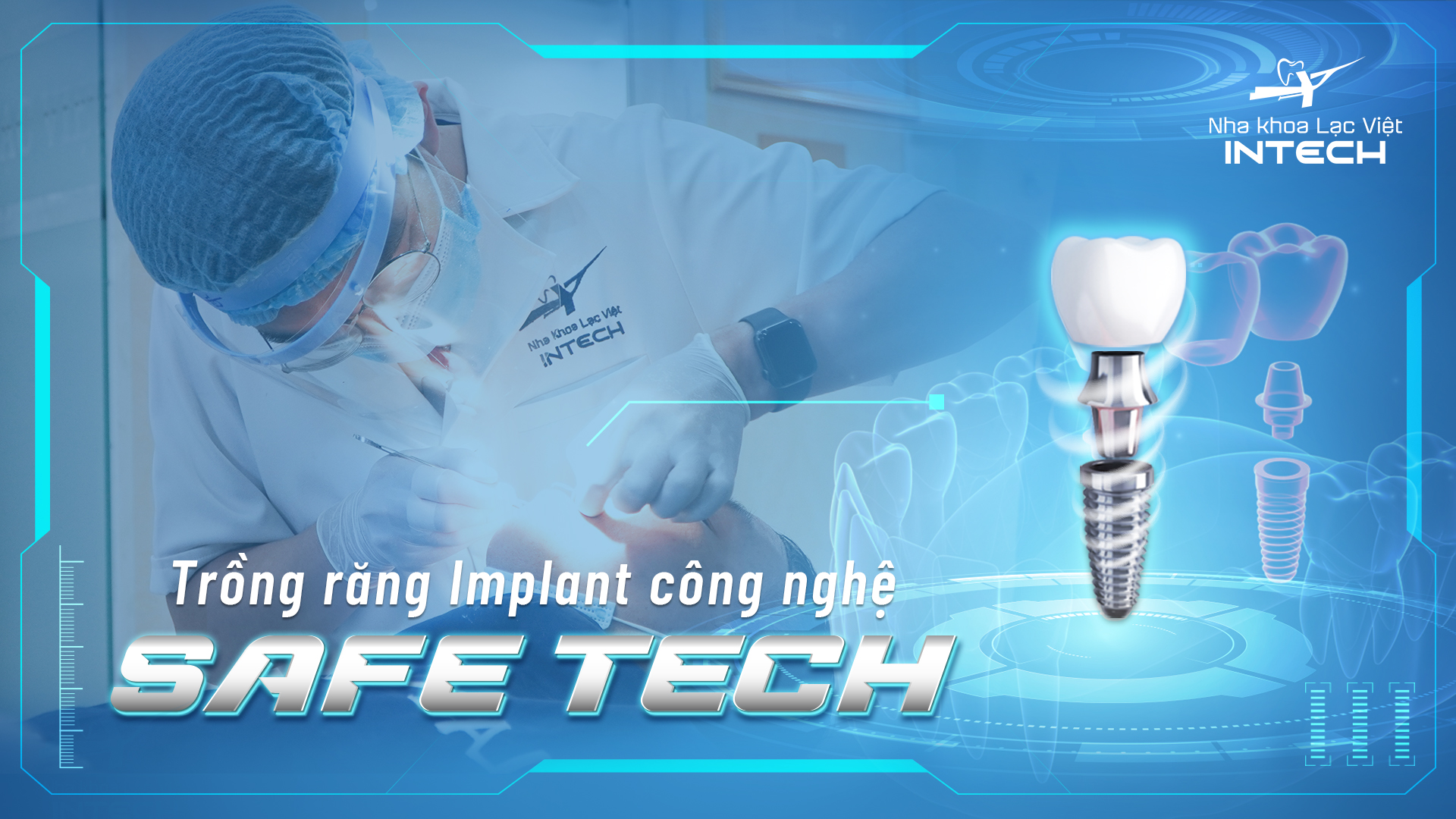 Công nghệ trồng răng Safe Tech độc quyền được ứng dụng tại Lạc Việt Intech