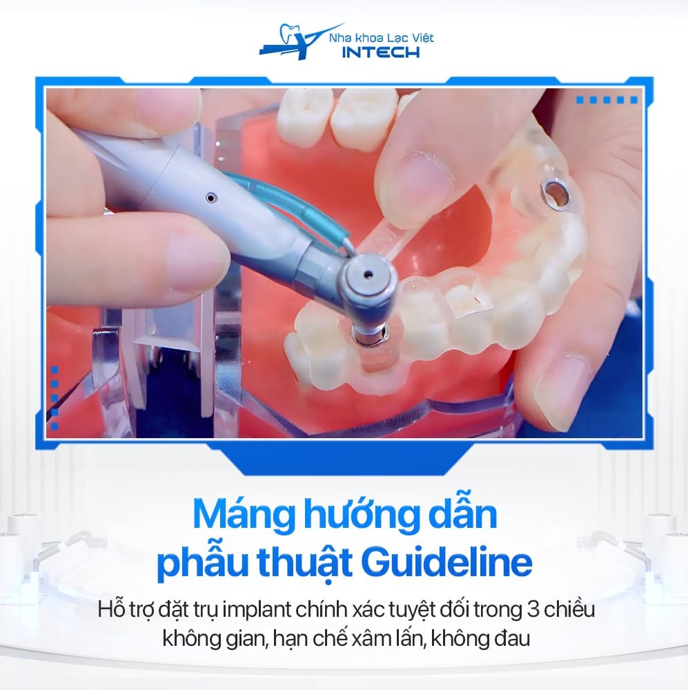 máng hướng dẫn phẫu thuật guideline