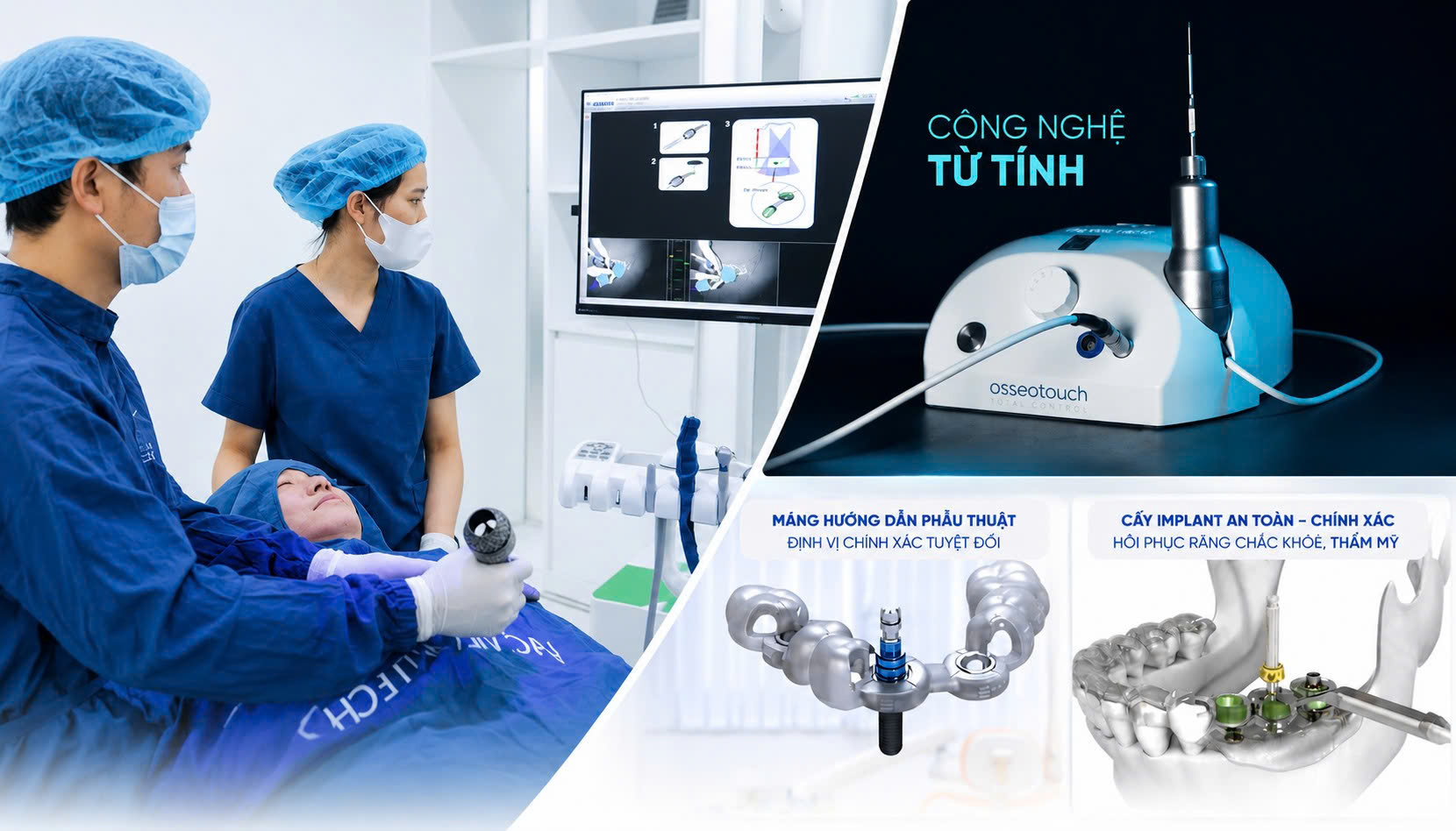 Nha khoa Lạc Việt Intech ứng dụng công nghệ hiện đại nhằm tăng độ bền và tính thẩm mỹ cho Implant.