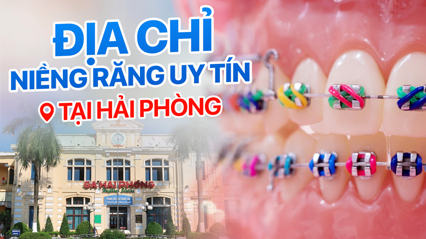 5 Kinh Nghiệm Chọn Địa Chỉ Niềng Răng Uy Tín Tại Hải Phòng Bắt Buộc Phải Biết 