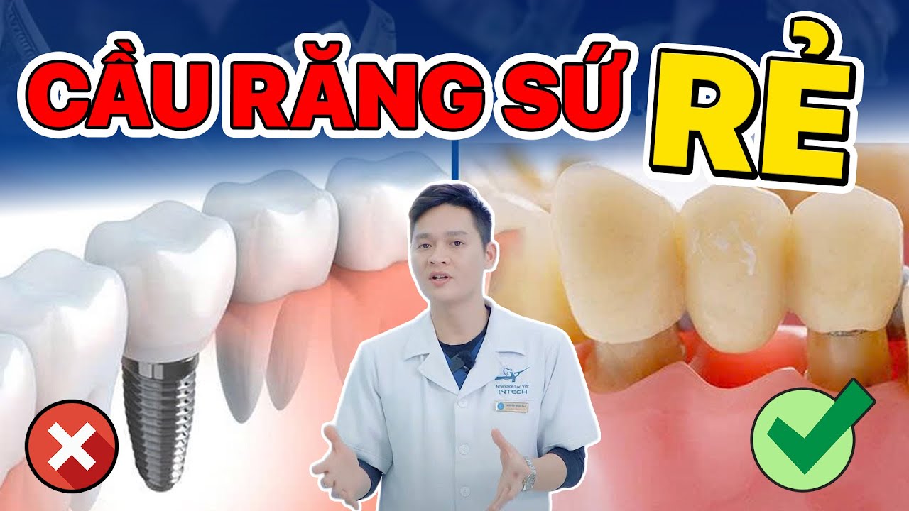 So Sánh Chi Phí Trồng Răng Implant và Cầu Răng Sứ | Có "Lãng Phí" Khi Làm Implant Không?