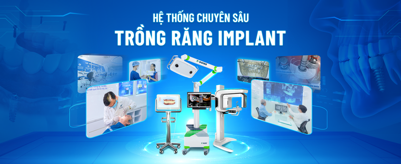 Lạc Việt Intech trang bị đầy đủ các dụng cụ hỗ trợ trồng răng công nghệ cao như máy chụp CT Cone Beam, thiết bị phẫu thuật từ tính