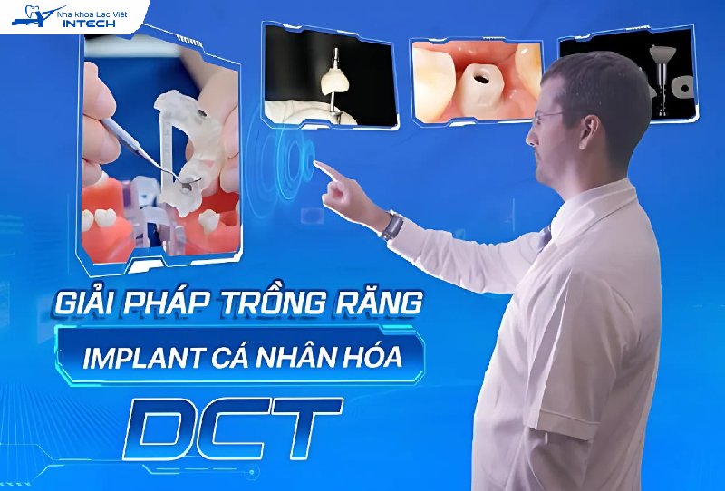 Giải pháp trồng răng Implant cá nhân hóa DCT là giải pháp độc quyền của Nha khoa Lạc Việt Intech