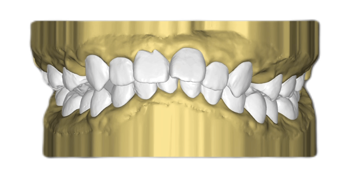 Nha khoa Lạc Việt Intech - Trung tâm trồng răng implant và chỉnh nha chuyên sâu