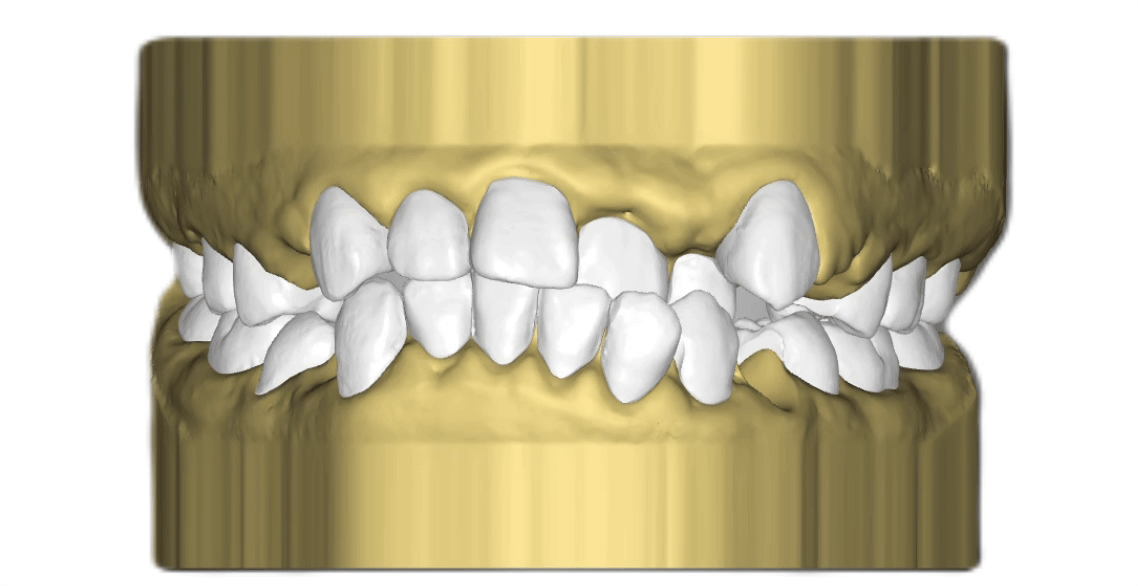 Nha khoa Lạc Việt Intech - Trung tâm trồng răng implant và chỉnh nha chuyên sâu