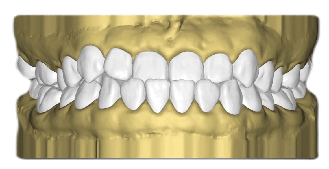 Nha khoa Lạc Việt Intech - Trung tâm trồng răng implant và chỉnh nha chuyên sâu