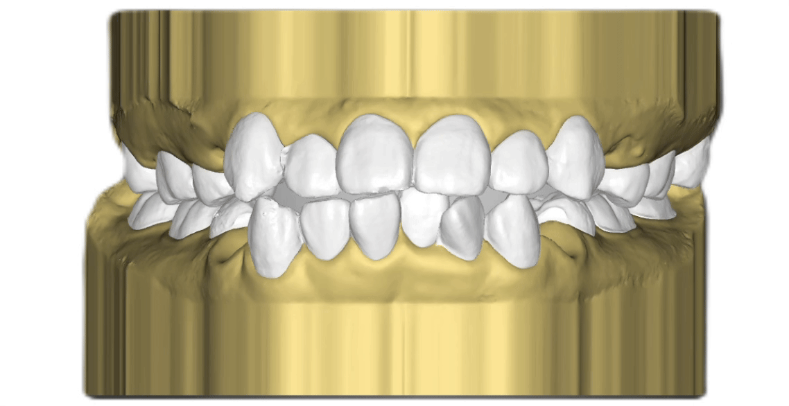 Nha khoa Lạc Việt Intech - Trung tâm trồng răng implant và chỉnh nha chuyên sâu