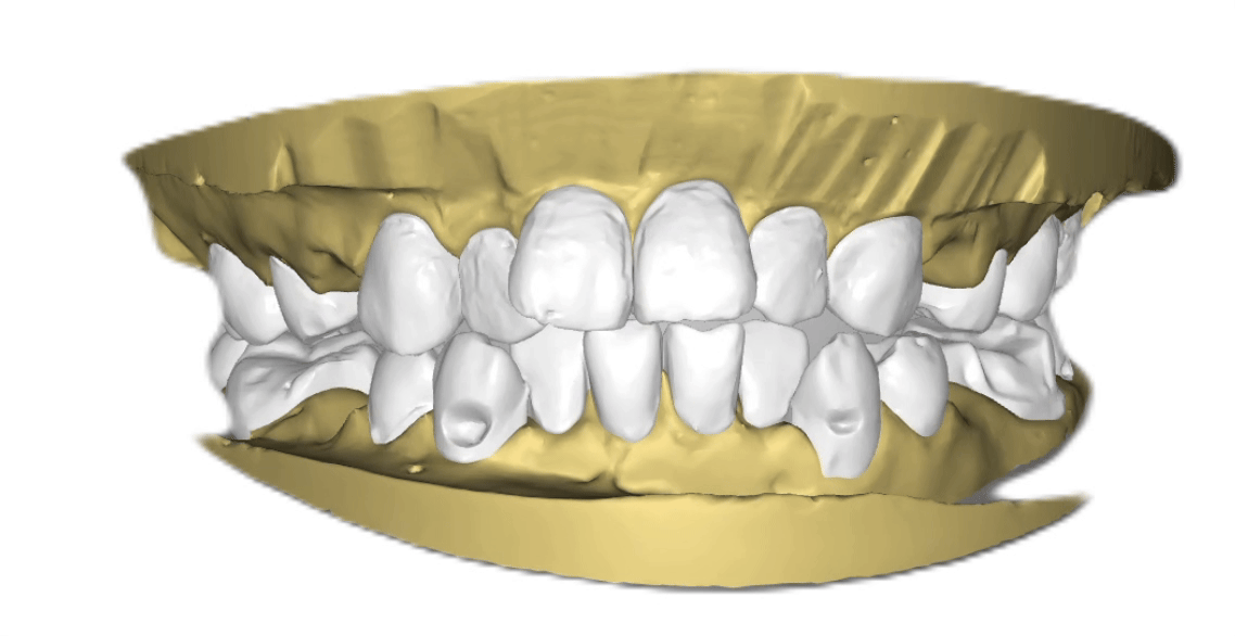 Nha khoa Lạc Việt Intech - Trung tâm trồng răng implant và chỉnh nha chuyên sâu