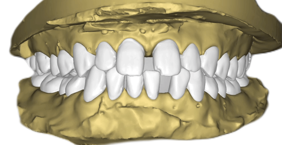 Nha khoa Lạc Việt Intech - Trung tâm trồng răng implant và chỉnh nha chuyên sâu