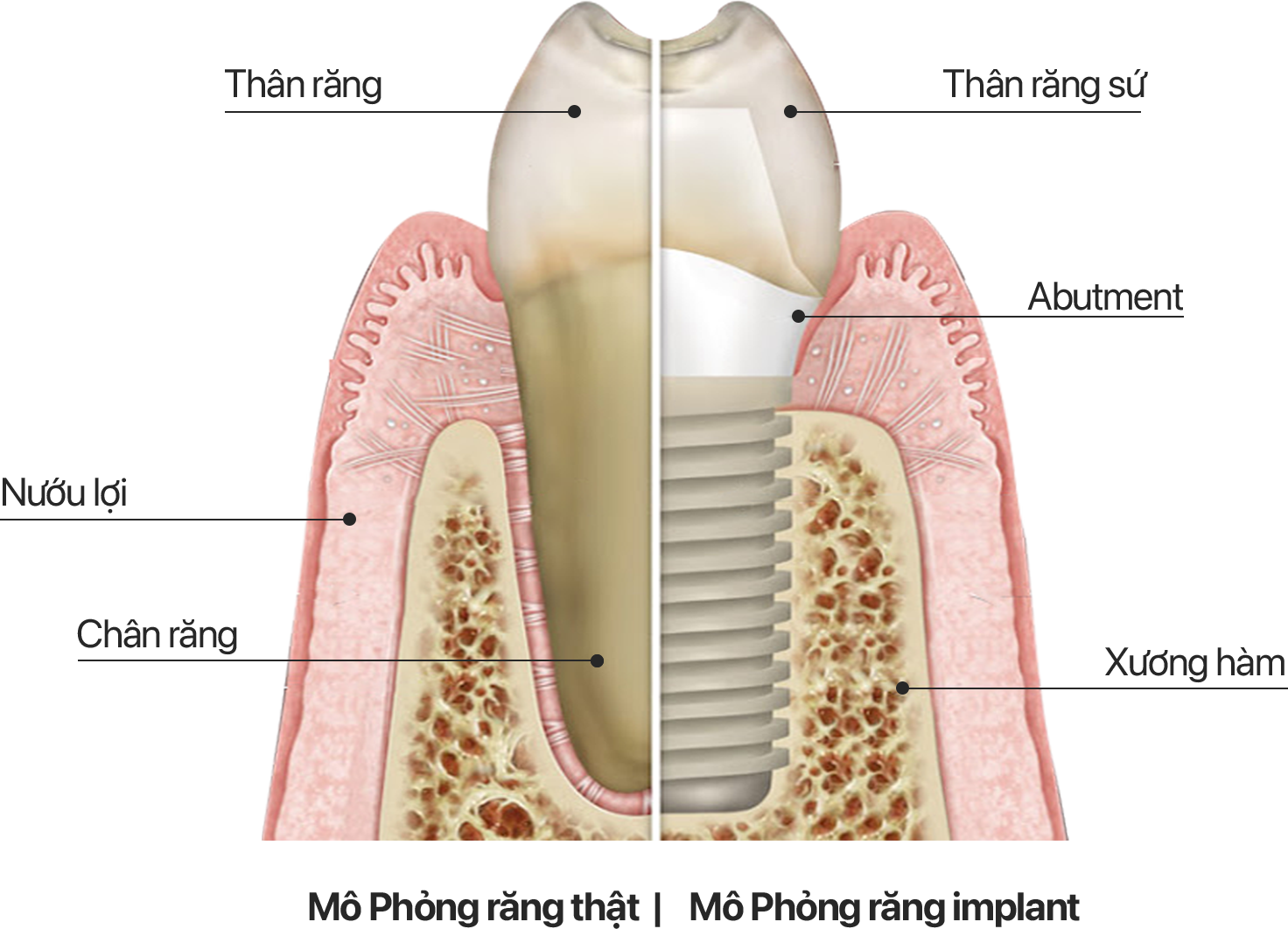 Nha khoa Lạc Việt Intech - Trung tâm trồng răng implant và chỉnh nha chuyên sâu
