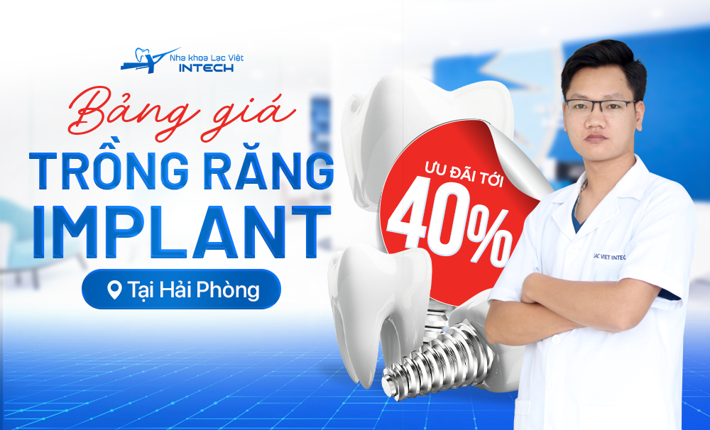 CHƯƠNG TRÌNH KHUYẾN MÃI ĐẶC BIỆT TẠI HẢI PHÒNG – GIẢM ĐẾN 40% CHI PHÍ TRỒNG RĂNG IMPLANT