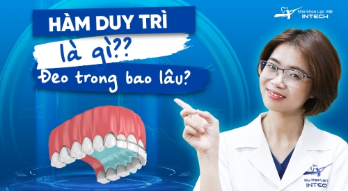 Hàm duy trì sau niềng răng là gì? Đeo trong bao lâu? Ưu nhược điểm từng loại