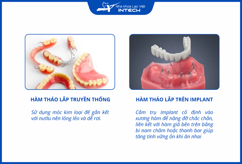 Hàm tháo lắp trên Implant: Ăn nhai thoải mái, tự tin như răng thật