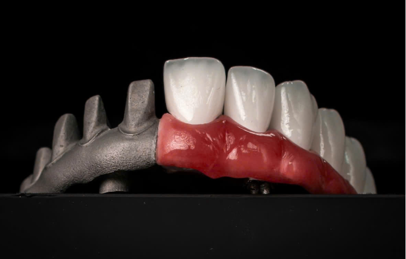 Hàm Thimble dễ dàng sửa chữa do cấu trúc răng rời.