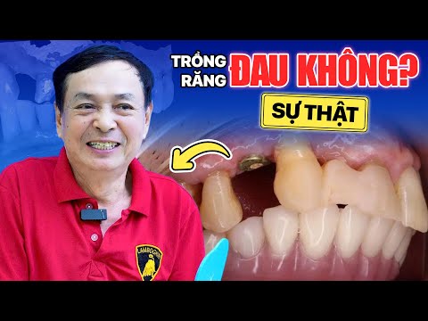 Nha khoa Lạc Việt Intech - Trung tâm trồng răng implant và chỉnh nha chuyên sâu
