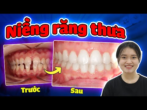 Nha khoa Lạc Việt Intech - Trung tâm trồng răng implant và chỉnh nha chuyên sâu
