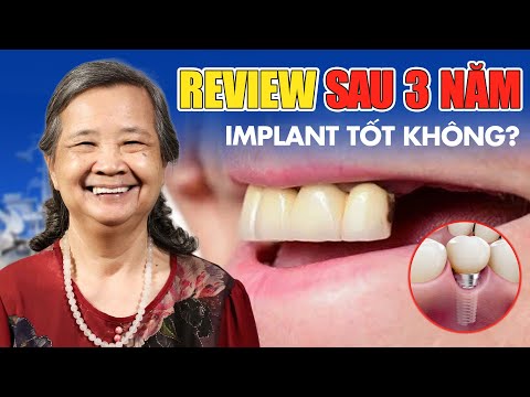 Nha khoa Lạc Việt Intech - Trung tâm trồng răng implant và chỉnh nha chuyên sâu