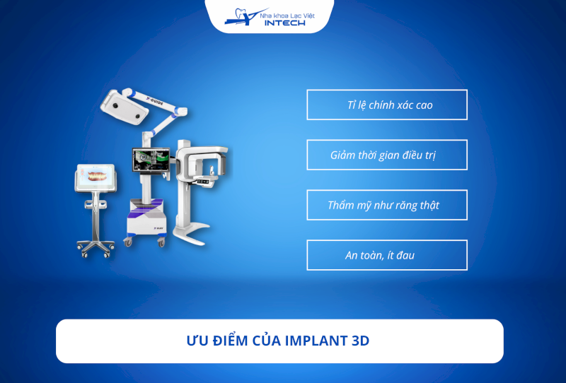 Công nghệ trồng răng Implant 3D: Chính xác lên đến 99,98%