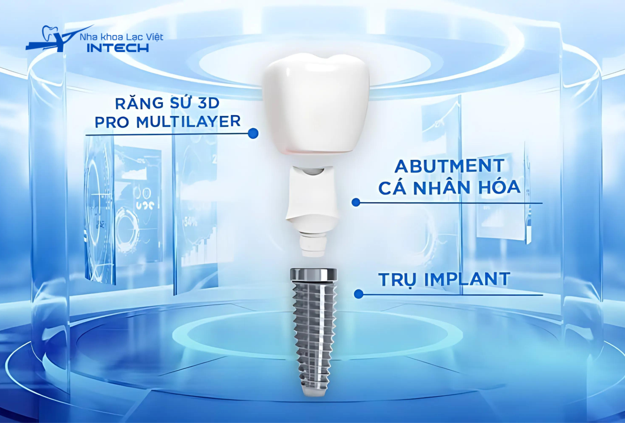 Implant cá nhân hóa khắc phục tình trạng giắt răng, giúp khách hàng dễ dàng vệ sinh từ đó ngăn ngừa hôi miệng