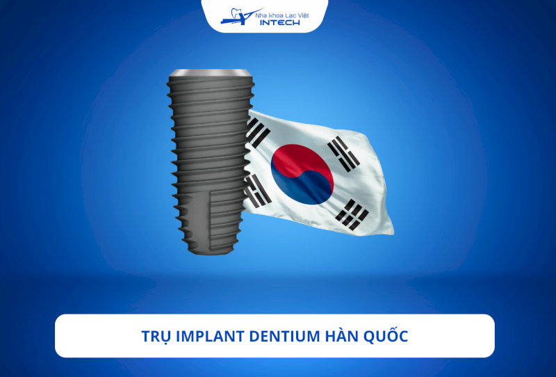 Tổng hợp thông tin từ A - Z về trụ Implant Dentium Hàn Quốc