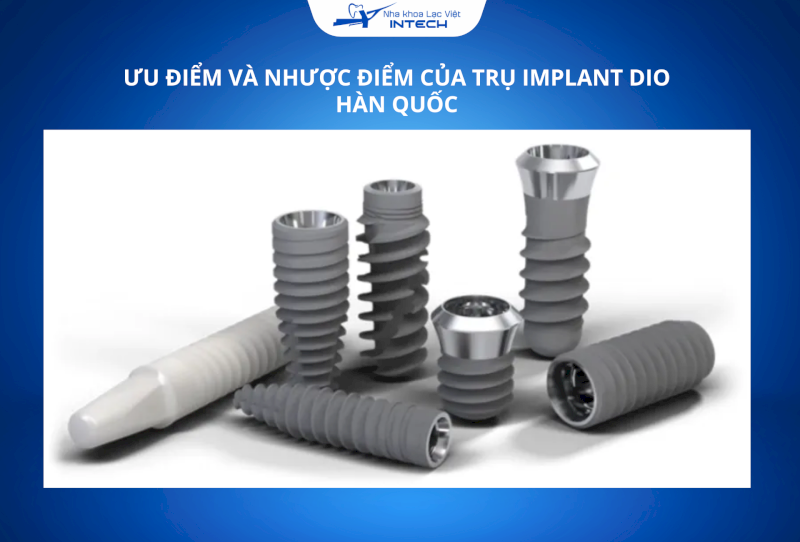 Giống như bất kỳ dòng trụ nào, Dio cũng có những điểm cần cân nhắc trước khi quyết định cấy ghép
