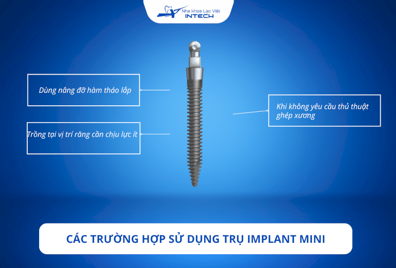 Để đảm bảo Implant mini được tồn tại bền vững và an toàn, cô chú/anh chị cần nghe tư vấn từ bác sĩ về các trường hợp được chỉ định rõ ràng