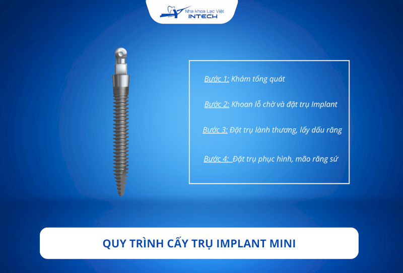 Quy trình trồng răng Implant mini tương tự như quy trình trồng các loại răng Implant thông thường