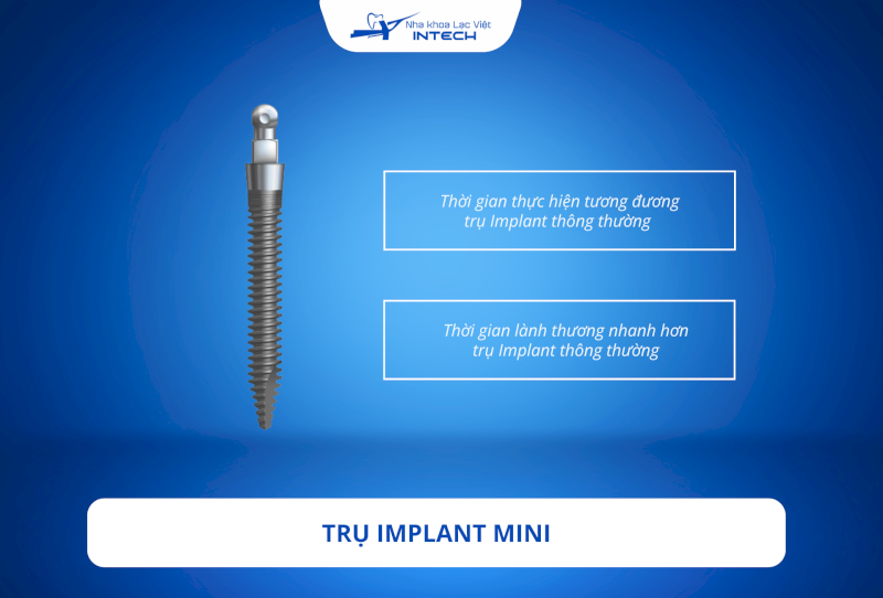 Thời gian cấy ghép và thời gian phục hồi sau khi trồng răng Implant mini tương đối nhanh chóng 