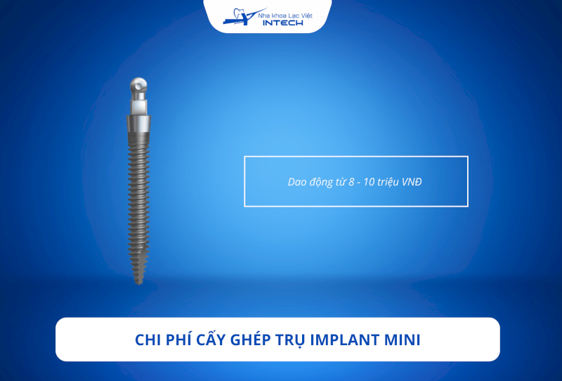 Trụ Implant mini có chi phí rẻ, phù hợp với điều kiện tài chính của nhiều cô chú/anh chị 