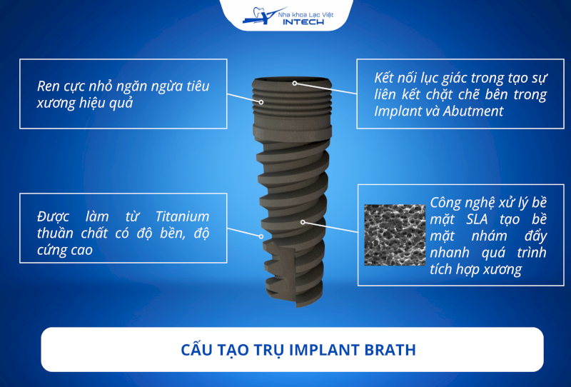 Trụ Implant Brath nổi bật với độ tương thích sinh học và tuổi thọ cao nhưng chưa phổ biến tại Việt Nam