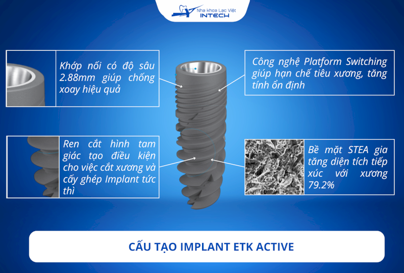 Trụ Implant ETK Active với các cải tiến giúp rút ngắn thời gian lành thương, tăng tỉ lệ thành công của các ca cấy ghép