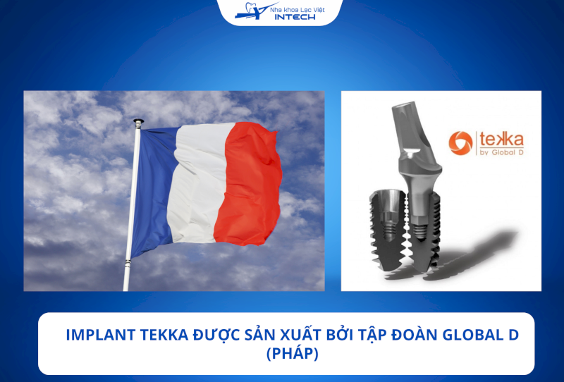Trụ Implant Tekka Pháp có điểm gì nổi bật so với các dòng trụ Implant khác?
