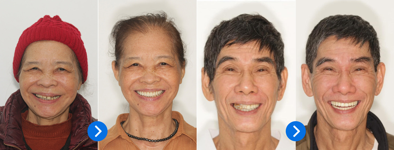 Nhiều ca trồng răng Implant phức tạp được thực hiện bởi bác sĩ Nguyễn Ngọc Bảo.