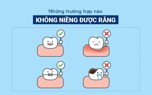 TRƯỜNG HỢP NÀO KHÔNG ĐƯỢC NIỀNG RĂNG?