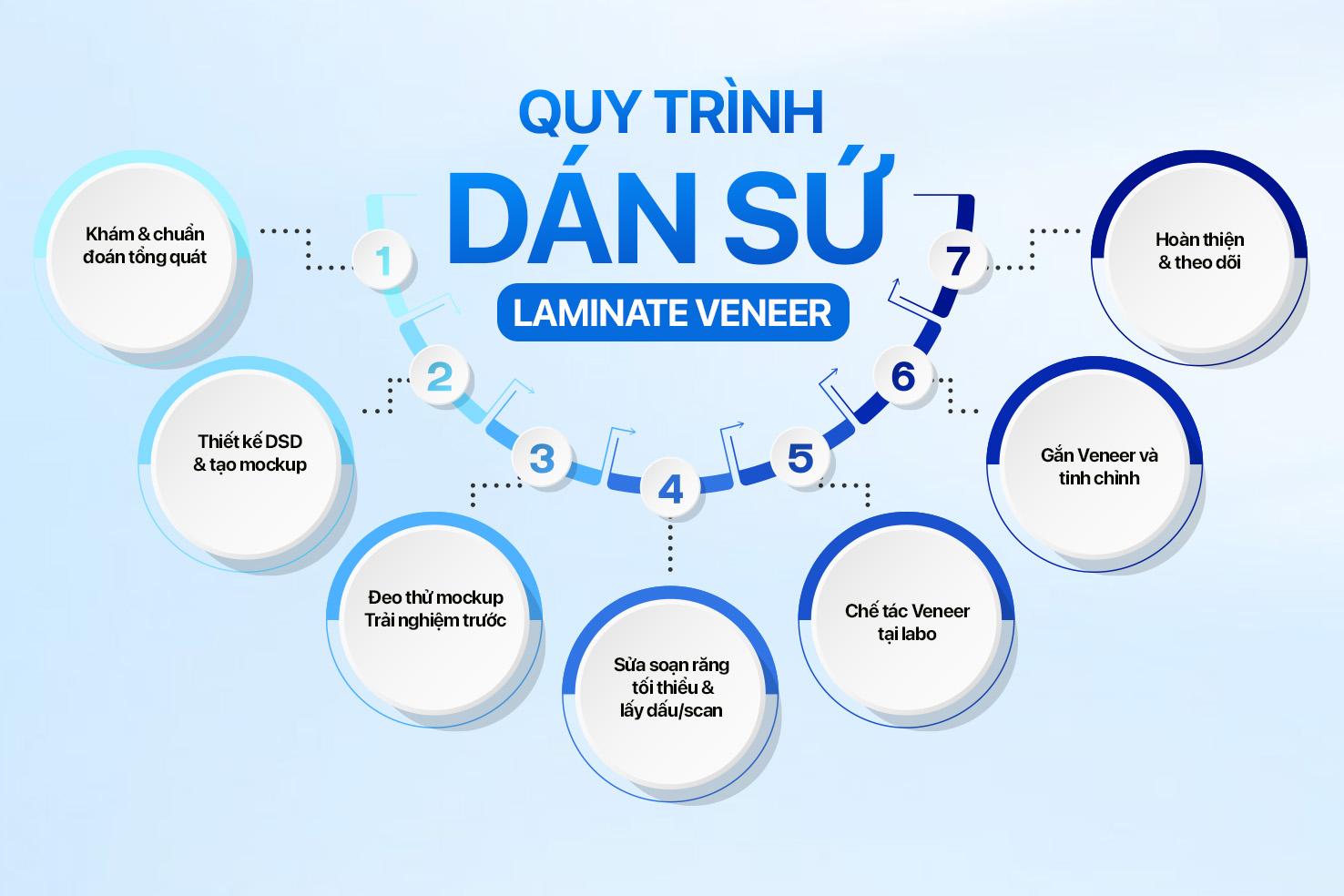 quy trình dán sứ chuẩn y khoa gồm 7 bước
