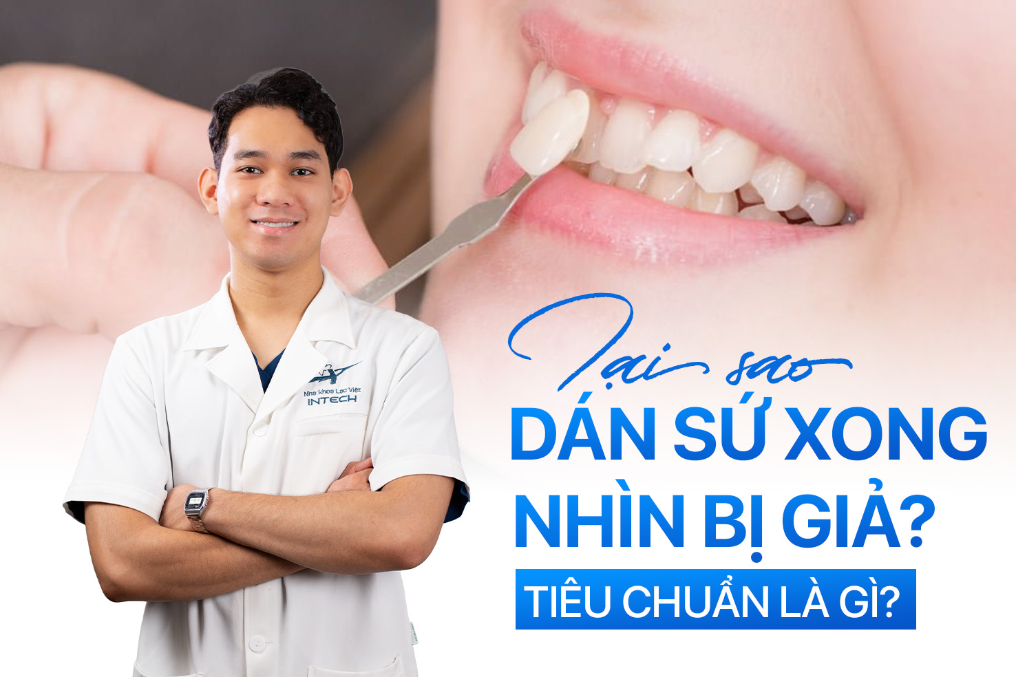 Dán veneer trắng nhưng vẫn “giả”: nguyên nhân nằm ở đâu