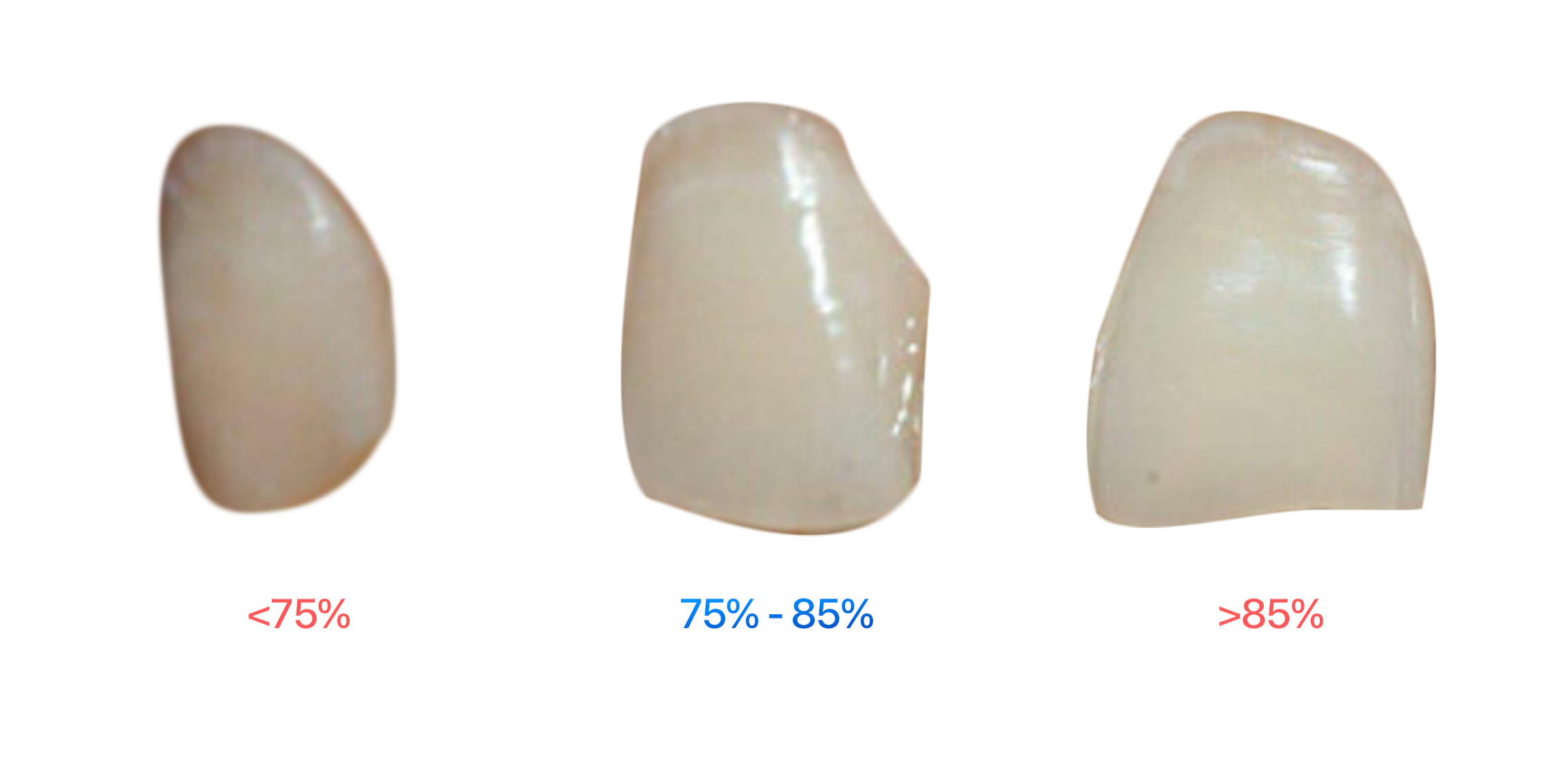 hình thể răng sứ thế nào là đẹp