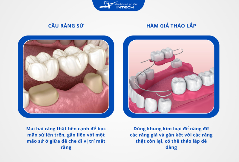 Về bản chất, cầu răng sứ và hàm giả tháo lắp không thay thế chân răng đã mất, mà tựa lực lên cái răng khỏe kế cận để lắp răng giả che đi khoảng trống