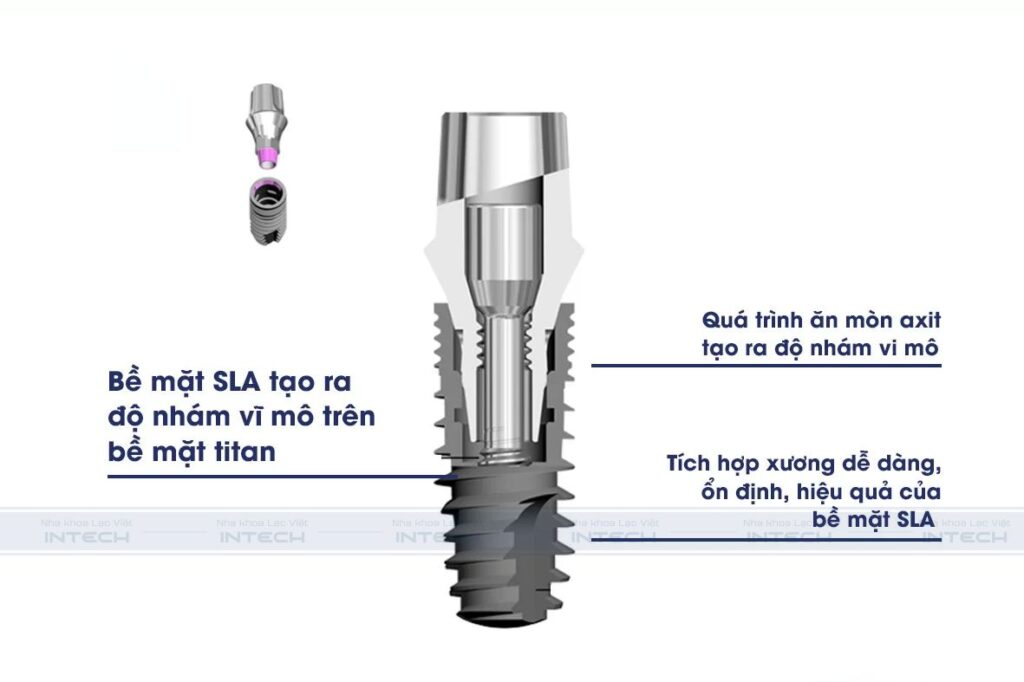 Cô chú/anh chị nên lựa chọn các dòng trụ tiên tiến, có khả năng tích hợp sinh học cao