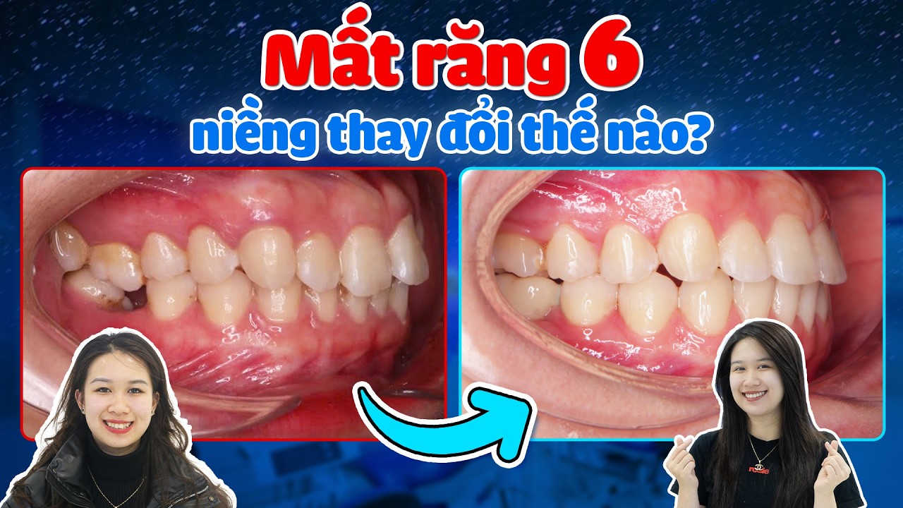 Nha khoa Lạc Việt Intech - Trung tâm trồng răng implant và chỉnh nha chuyên sâu