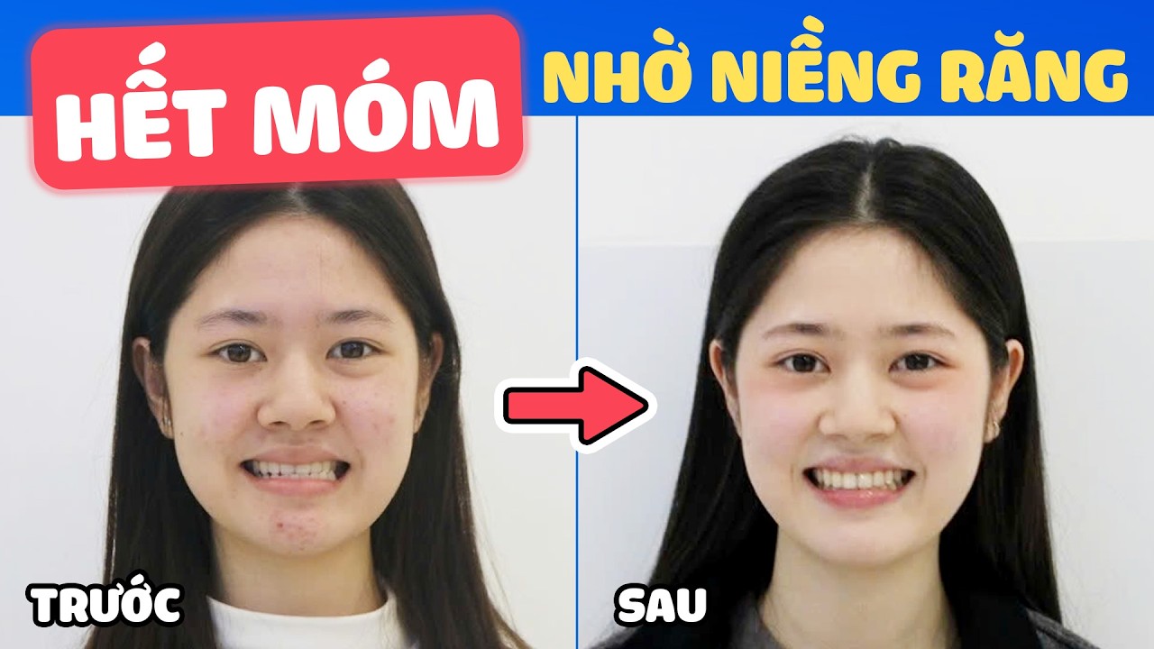 Nha khoa Lạc Việt Intech - Trung tâm trồng răng implant và chỉnh nha chuyên sâu