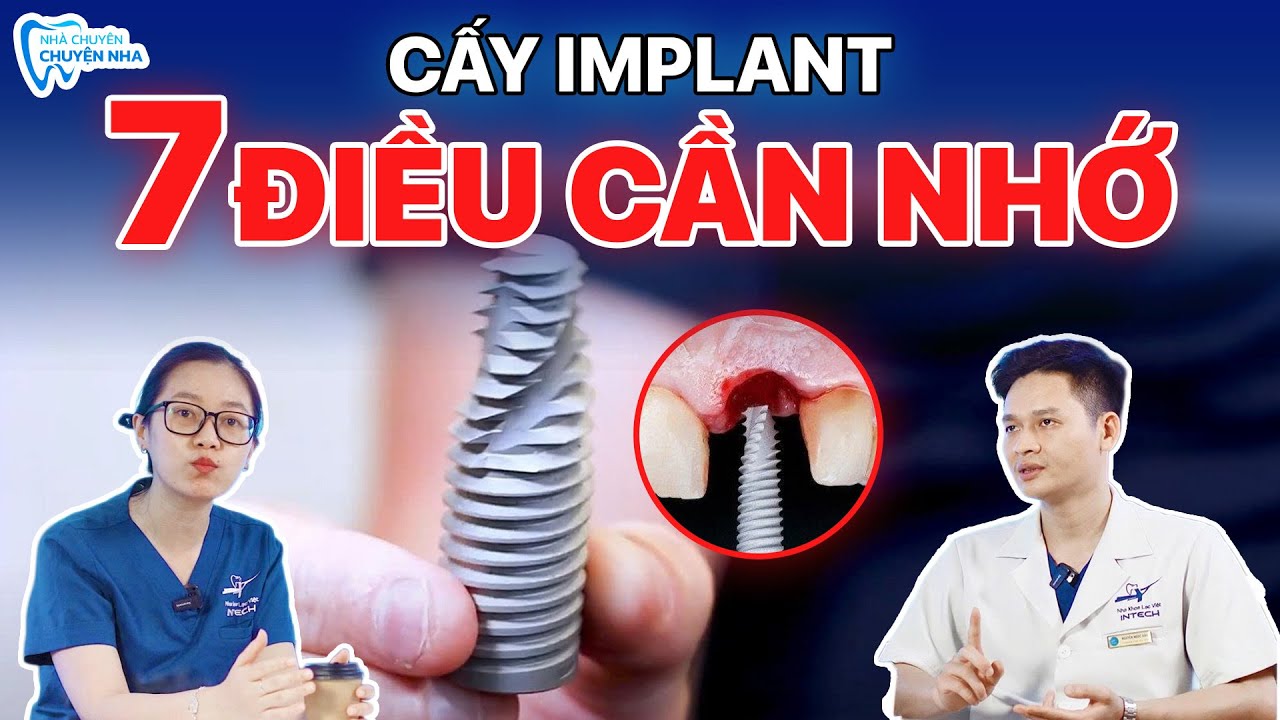 7 Điều Đừng Bao Giờ Quên Nếu Đã Chọn Cấy Ghép Implant!