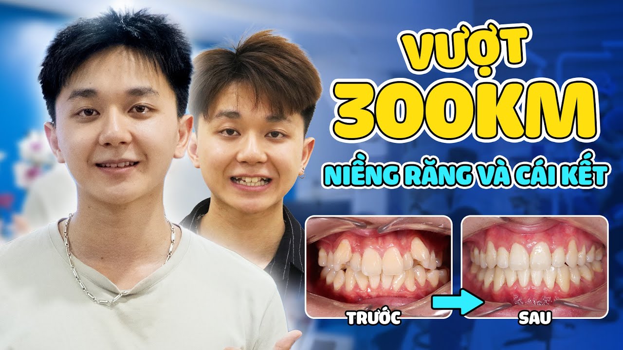 Nha khoa Lạc Việt Intech - Trung tâm trồng răng implant và chỉnh nha chuyên sâu