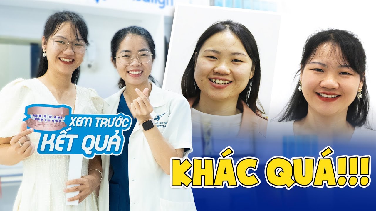 Nha khoa Lạc Việt Intech - Trung tâm trồng răng implant và chỉnh nha chuyên sâu