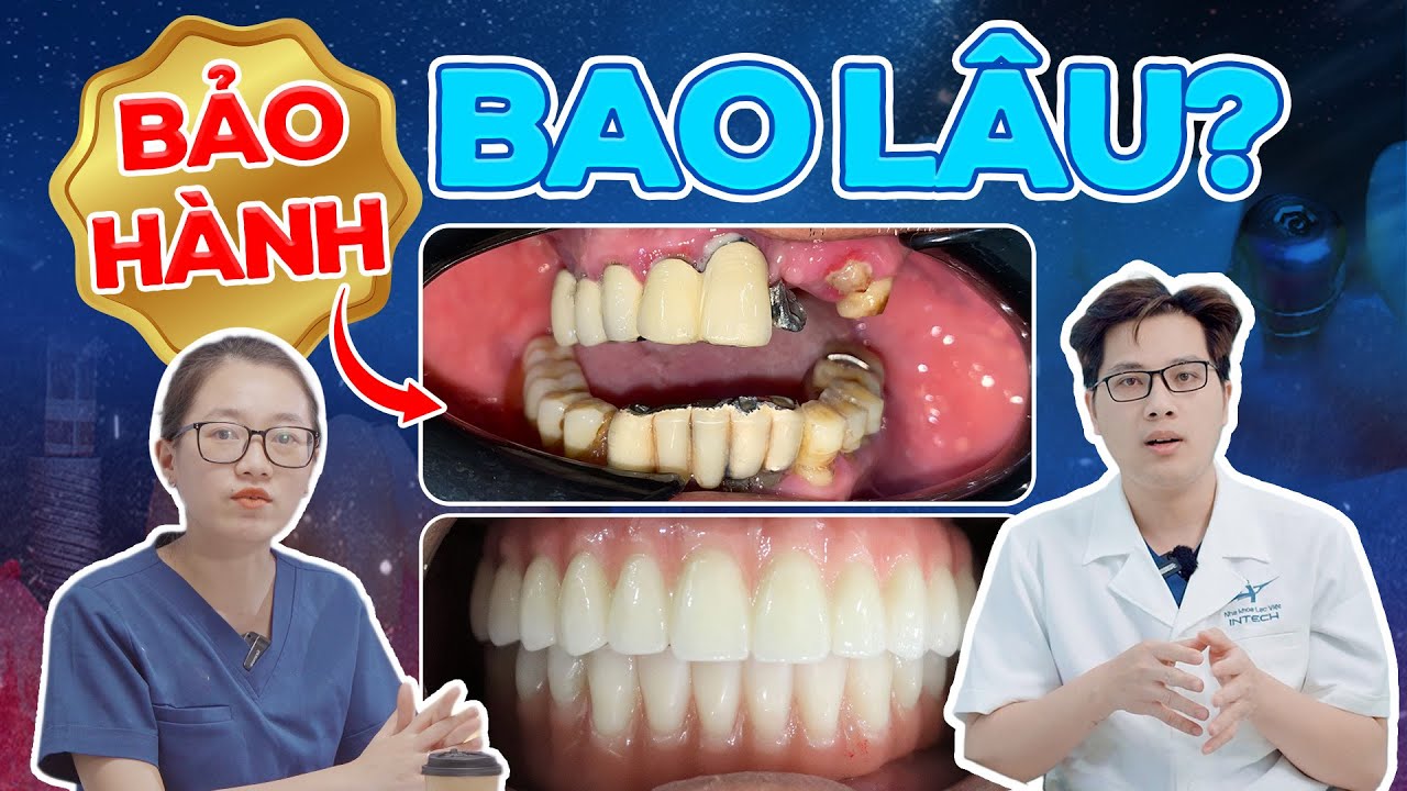 Chính Sách Bảo Hành Trồng Implant 1:1: Sự Thật Từ Chuyên Gia