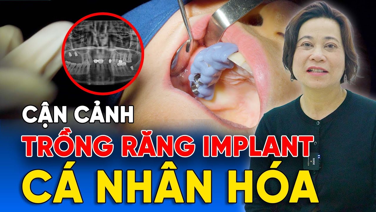 Nha khoa Lạc Việt Intech - Trung tâm trồng răng implant và chỉnh nha chuyên sâu